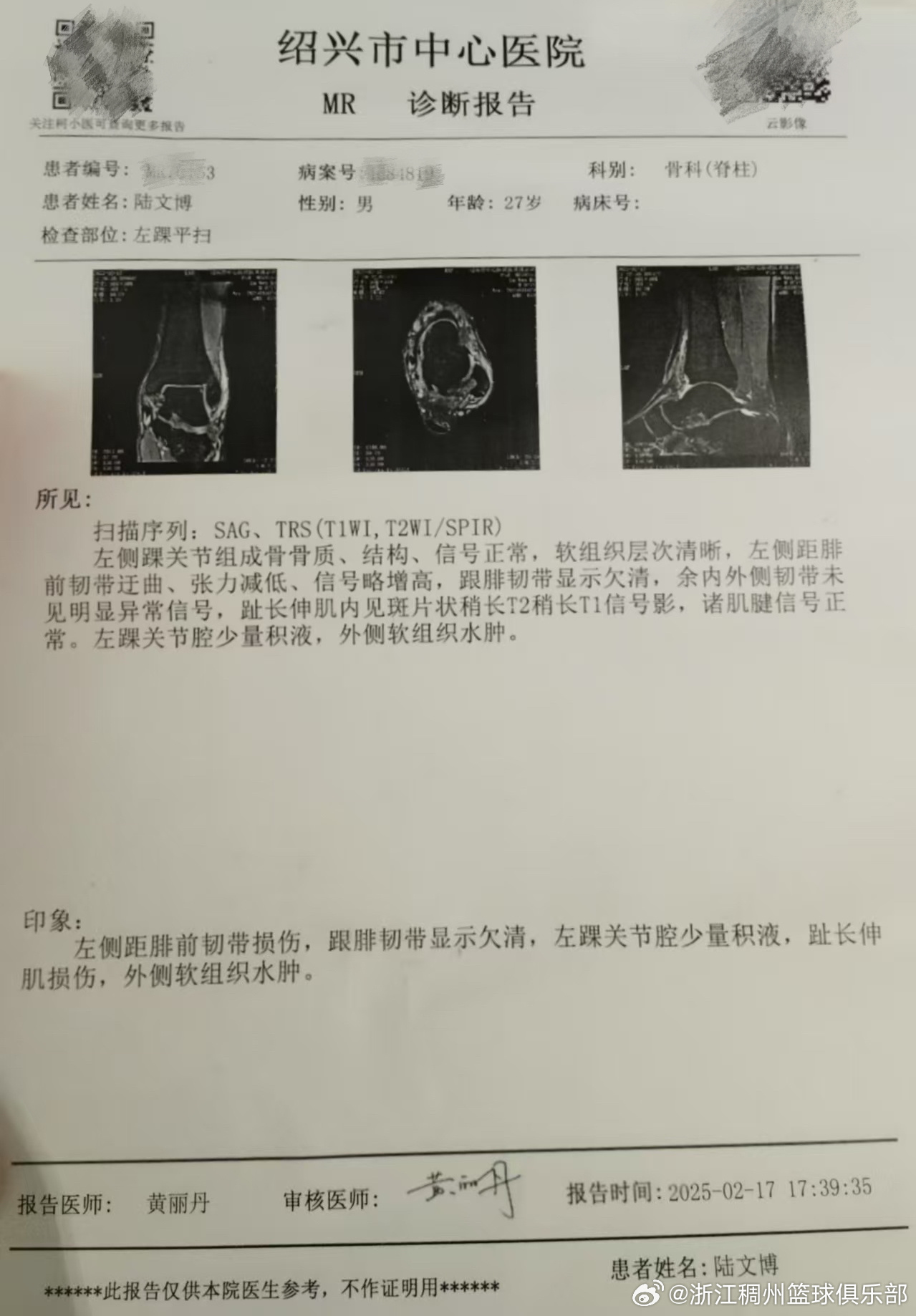 这一简单却
